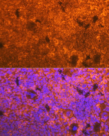 CD3d Antibody in Immunohistochemistry (Paraffin) (IHC (P))