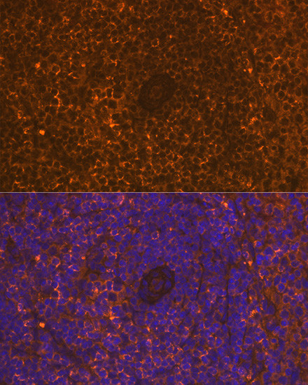 CD30 Antibody in Immunohistochemistry (Paraffin) (IHC (P))