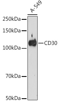 CD30 Antibody in Western Blot (WB)