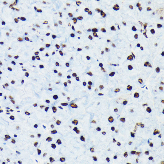 Phospho-Rb (Ser780) Antibody in Immunohistochemistry (Paraffin) (IHC (P))