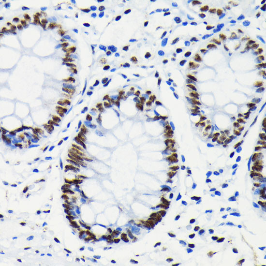 Phospho-Rb (Ser780) Antibody in Immunohistochemistry (Paraffin) (IHC (P))