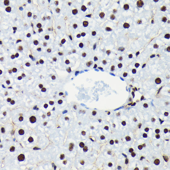 Phospho-Rb (Ser780) Antibody in Immunohistochemistry (Paraffin) (IHC (P))