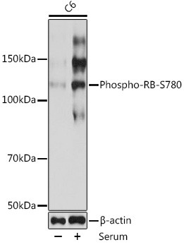 Phospho-Rb (Ser780) Antibody in Western Blot (WB)