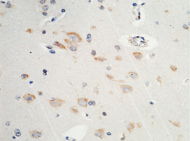 PDI Antibody in Immunohistochemistry (Paraffin) (IHC (P))