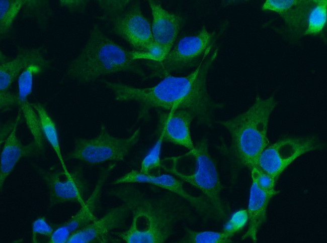 Doublecortin Antibody in Immunocytochemistry (ICC/IF)