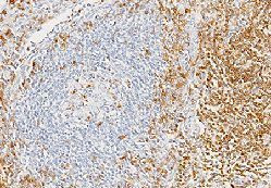 CD7 Antibody in Immunohistochemistry (Paraffin) (IHC (P))