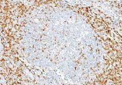 CD7 Antibody in Immunohistochemistry (Paraffin) (IHC (P))