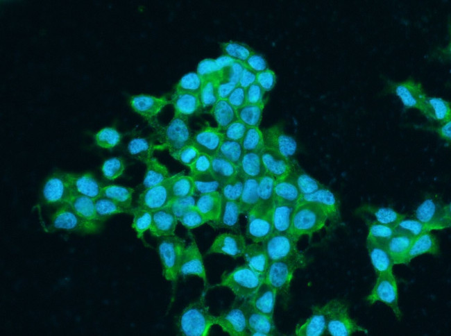 IGF1R (CD221) Antibody in Immunocytochemistry (ICC/IF)