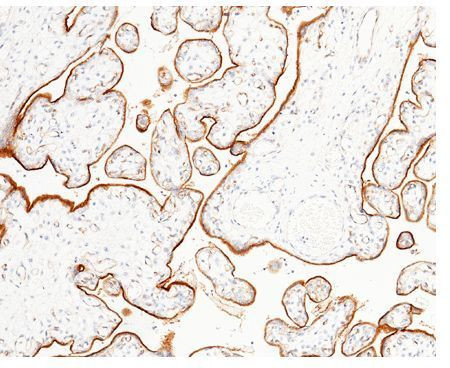 LIFR Antibody in Immunohistochemistry (Paraffin) (IHC (P))