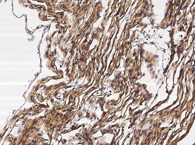 Neuropilin 1 Antibody in Immunohistochemistry (Paraffin) (IHC (P))