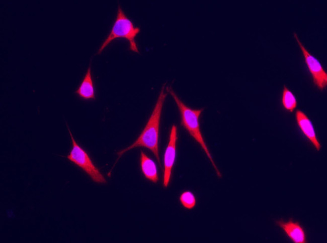 S100A7 Antibody in Immunocytochemistry (ICC/IF)