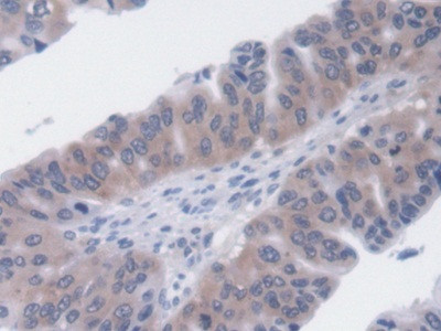 UCP2 Antibody in Immunohistochemistry (Paraffin) (IHC (P))