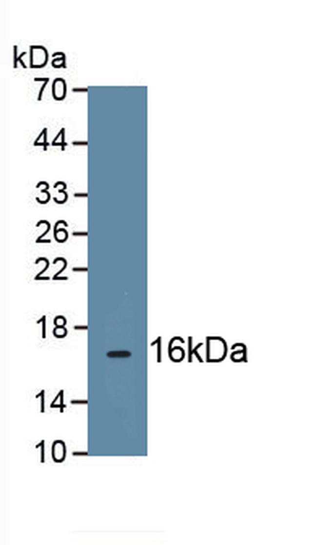 UCP2 Antibody in Western Blot (WB)