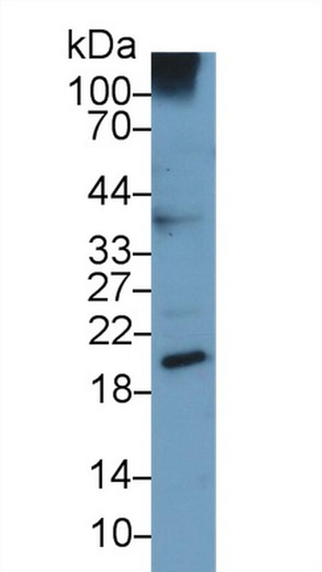 UCN3 Antibody in Western Blot (WB)