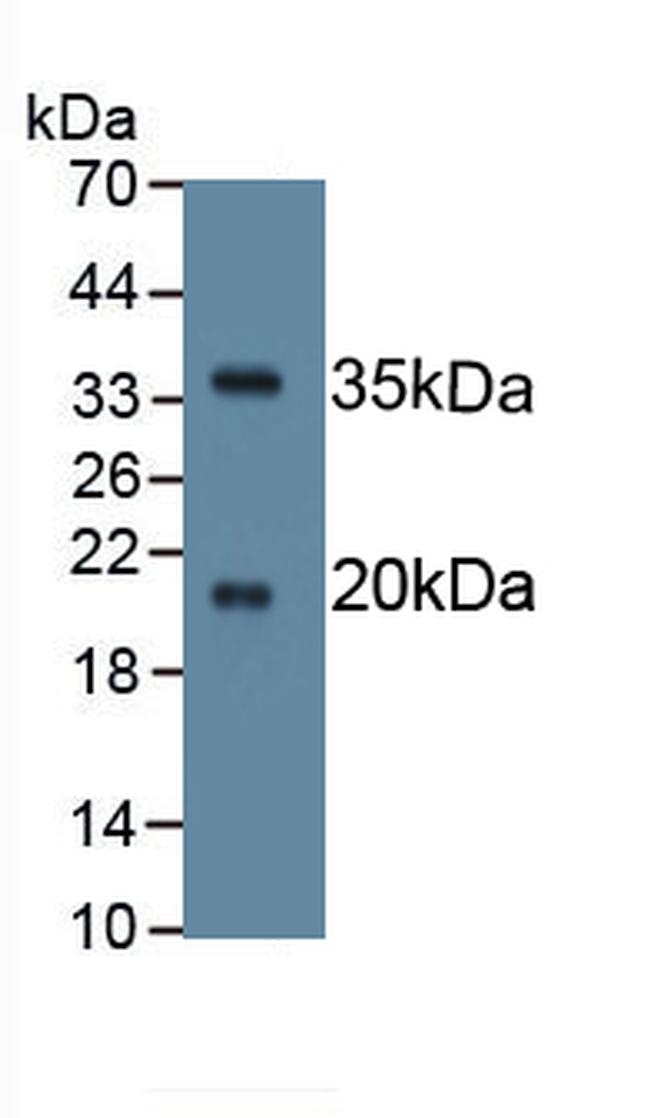 SPINK5 Antibody in Western Blot (WB)