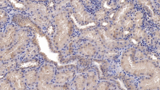 SFRP1 Antibody in Immunohistochemistry (Paraffin) (IHC (P))