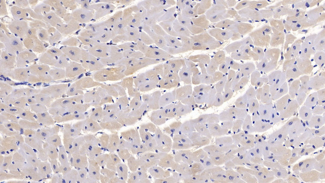 SEMA5B Antibody in Immunohistochemistry (Paraffin) (IHC (P))