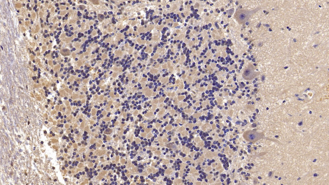 SEMA5B Antibody in Immunohistochemistry (Paraffin) (IHC (P))