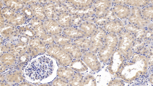 SEMA3A Antibody in Immunohistochemistry (Paraffin) (IHC (P))