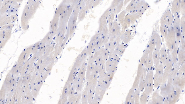 SEMA3A Antibody in Immunohistochemistry (Paraffin) (IHC (P))