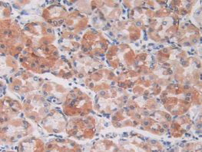 S100A5 Antibody in Immunohistochemistry (Paraffin) (IHC (P))