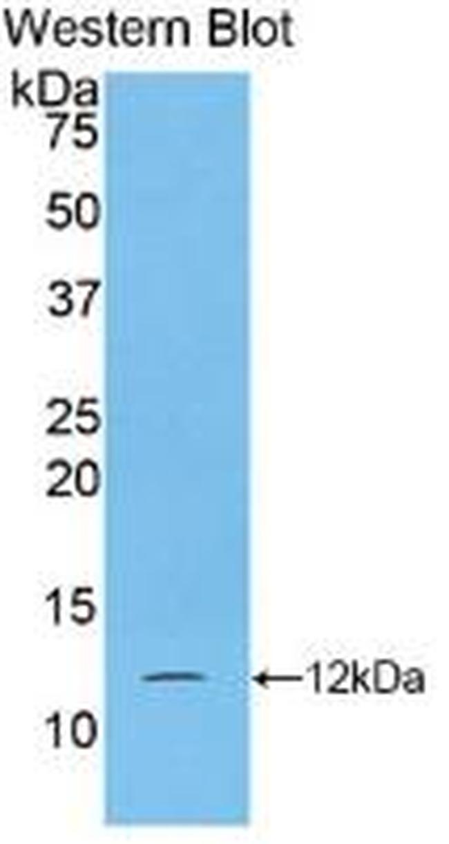 S100A5 Antibody in Western Blot (WB)