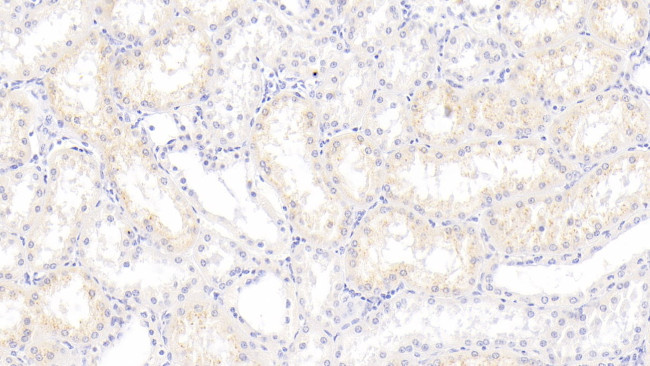 S100A3 Antibody in Immunohistochemistry (Paraffin) (IHC (P))