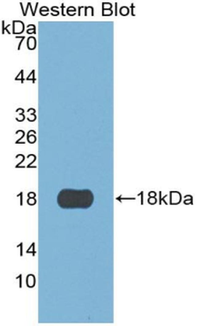 S100A3 Antibody in Western Blot (WB)