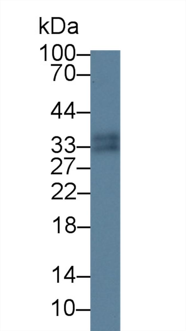 S100A12 Antibody in Western Blot (WB)