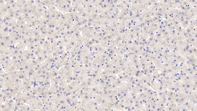 ROS1 Antibody in Immunohistochemistry (Paraffin) (IHC (P))