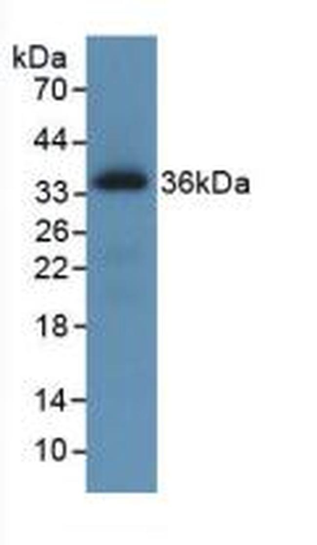 ROS1 Antibody in Western Blot (WB)