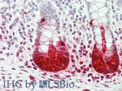 REG3A Antibody in Immunohistochemistry (Paraffin) (IHC (P))