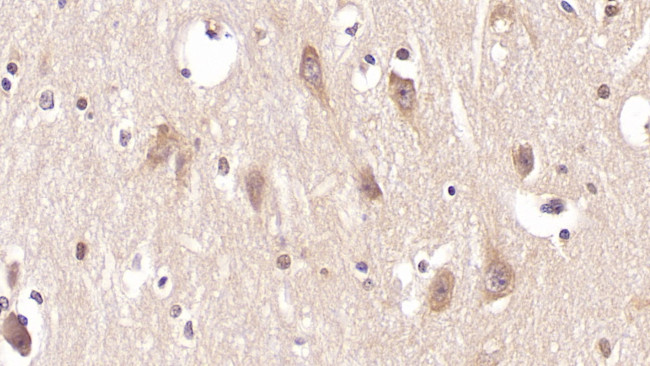 PTH2R Antibody in Immunohistochemistry (Paraffin) (IHC (P))