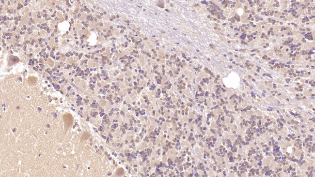 PTH2R Antibody in Immunohistochemistry (Paraffin) (IHC (P))