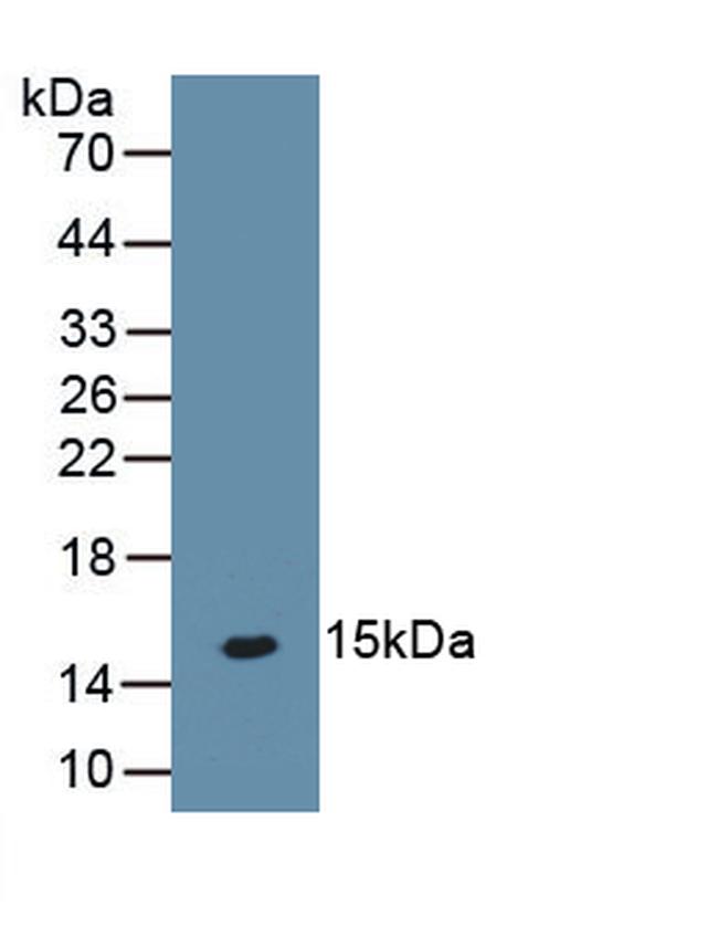 PTH2R Antibody in Western Blot (WB)