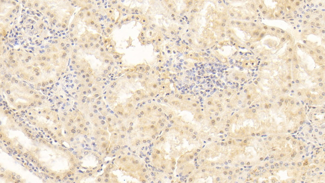 Periostin Antibody in Immunohistochemistry (Paraffin) (IHC (P))