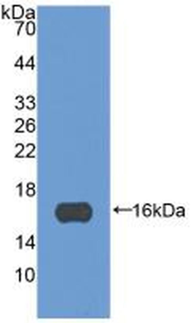 Periostin Antibody in Western Blot (WB)