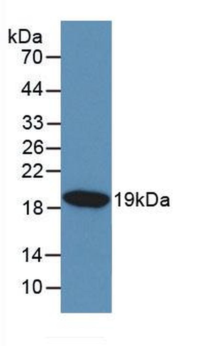 KISS1 Antibody in Western Blot (WB)