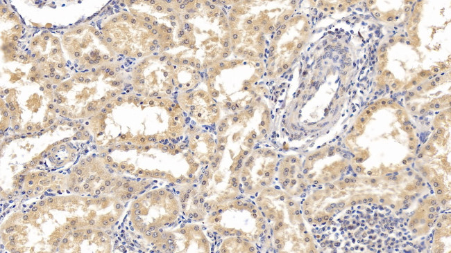 Interferon alpha-21 Antibody in Immunohistochemistry (Paraffin) (IHC (P))