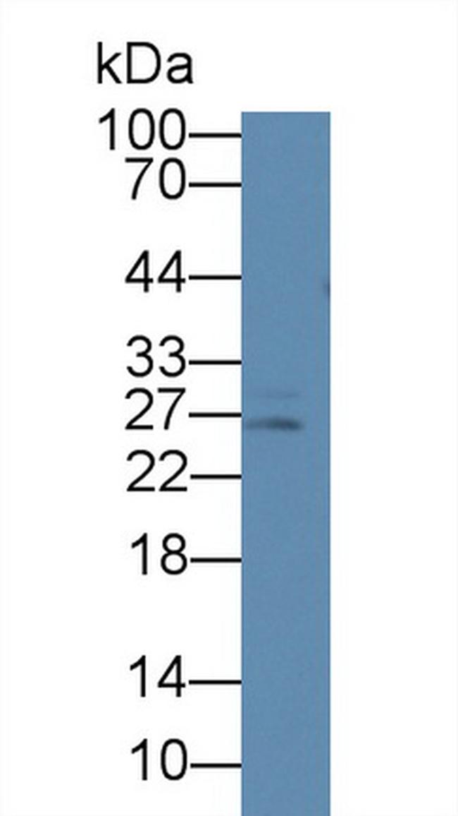 Prolactin Antibody in Western Blot (WB)