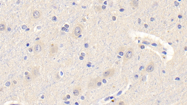 Leptin Antibody in Immunohistochemistry (Paraffin) (IHC (P))