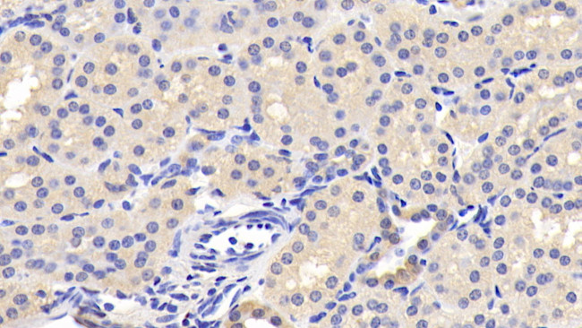 Leptin Antibody in Immunohistochemistry (Paraffin) (IHC (P))