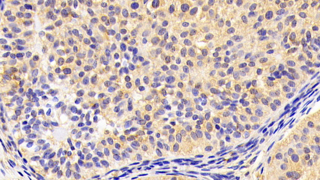 INHA Antibody in Immunohistochemistry (Paraffin) (IHC (P))