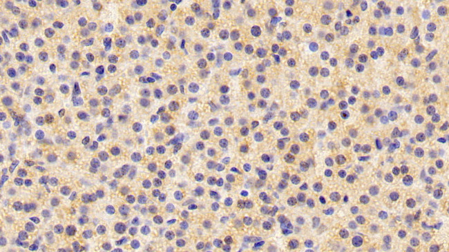 INHA Antibody in Immunohistochemistry (Paraffin) (IHC (P))