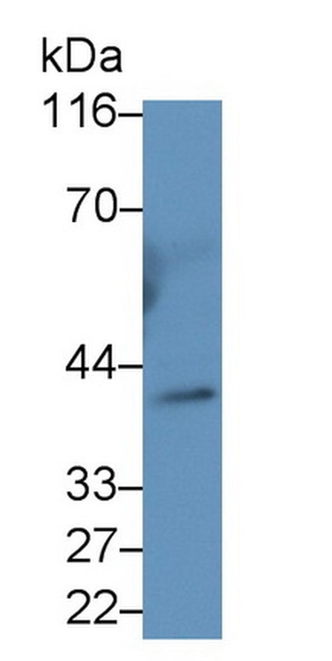 INHA Antibody in Western Blot (WB)