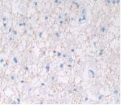 IL-28A Antibody in Immunohistochemistry (Paraffin) (IHC (P))