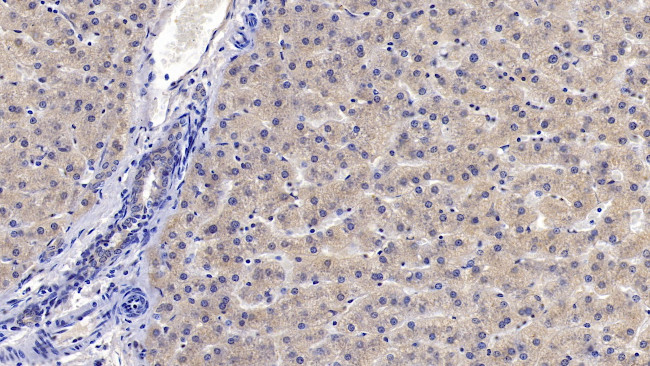 IGFBP4 Antibody in Immunohistochemistry (Paraffin) (IHC (P))