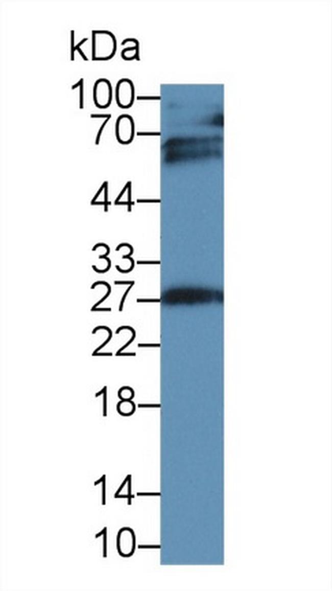 IGFBP4 Antibody in Western Blot (WB)