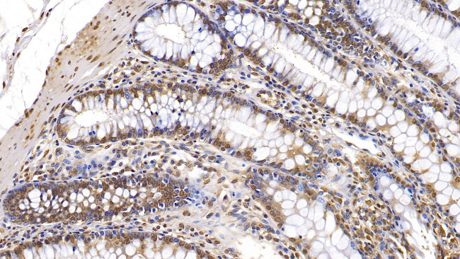 Interferon beta Antibody in Immunohistochemistry (Paraffin) (IHC (P))