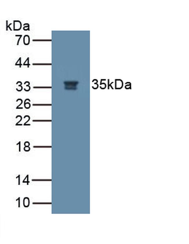 NGF Antibody in Western Blot (WB)